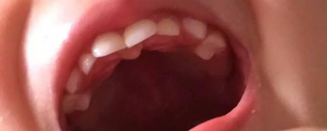 宝宝长牙的时间及顺序